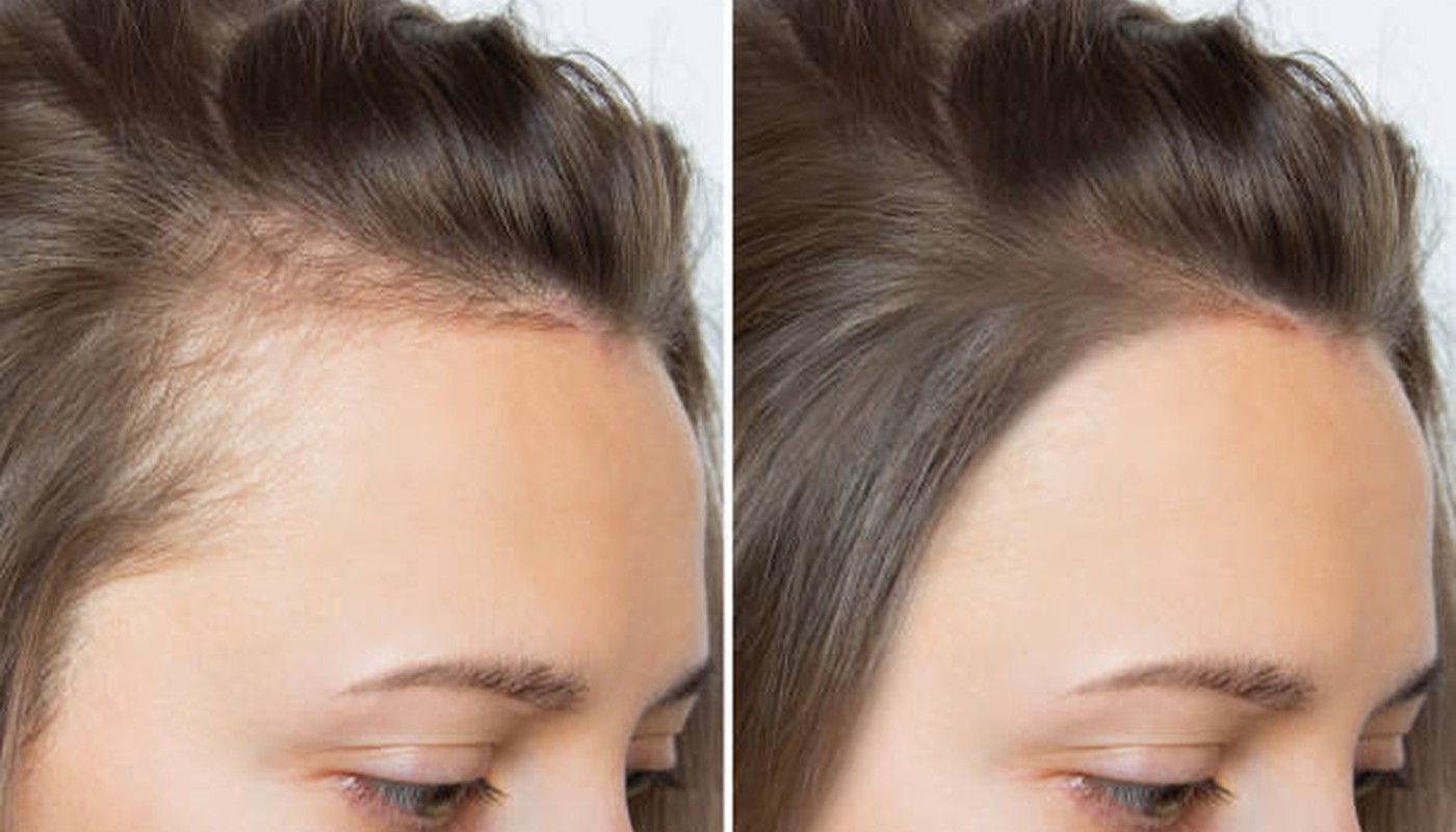 Hair Growth wellness guide
